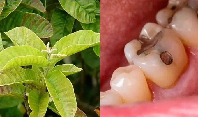 Toothache: ఈ ఒక్క ఆకుతో మీ పంటి నొప్పిని మరియు పిప్పి పళ్ళ సమస్యను తగ్గించుకోవచ్చు..ఆ చిట్కా ఏంటంటే…!