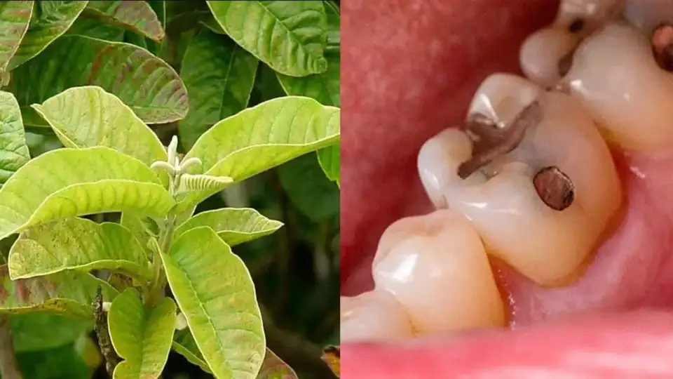 Toothache